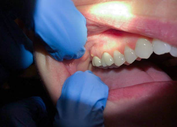 Best Emergency Broken Tooth Repair in East Troy, WI